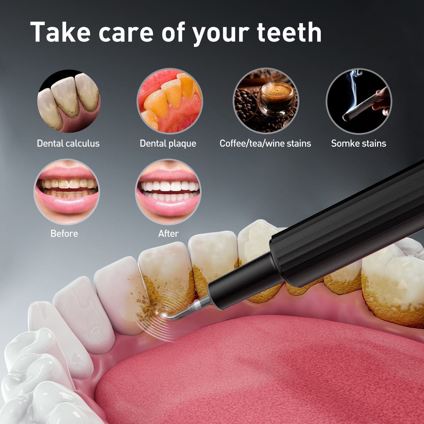 Plaque Remover for Teeth - Tartar Remover for Teeth, Dental Calculus Remover Teeth Cleaning Kit 4 Speed Modes with 4 Replaceable Heads, IPX6 Waterproof with LED Light